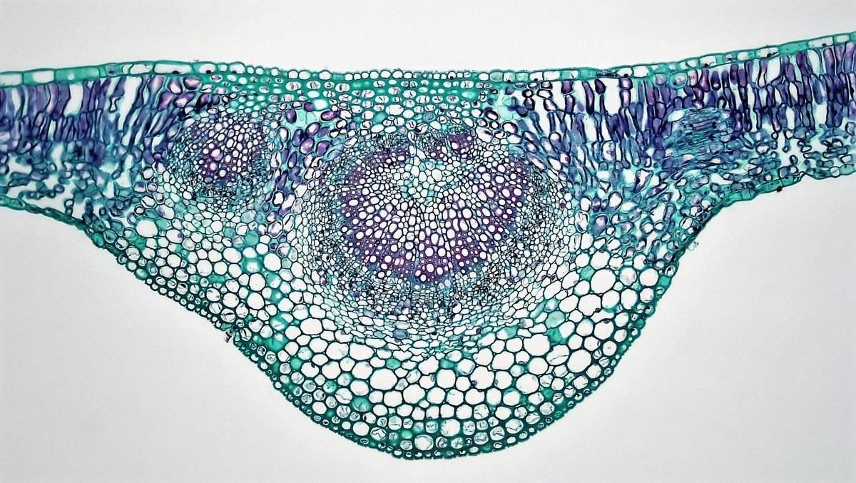 Microscopic view of diatom plant cells showing silica shells and rich pigment